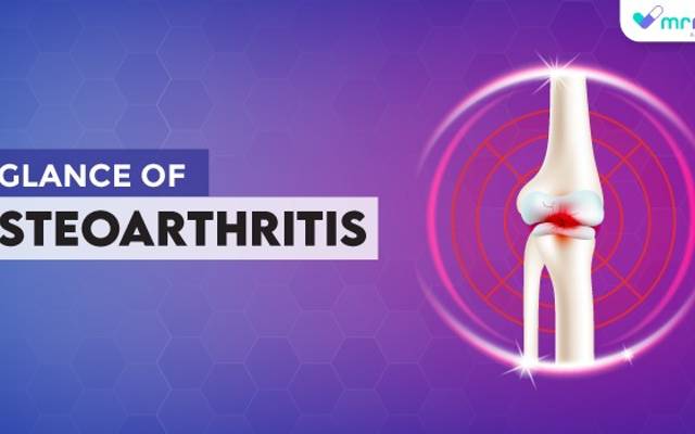 A Glance of Osteoarthritis