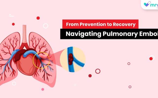 From Prevention to Recovery: Navigating Pulmonary Embolism