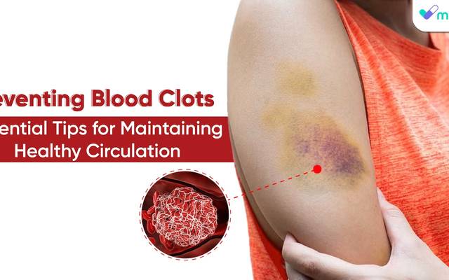 Preventing Blood Clots: Essential Tips for Maintaining Healthy Circulation