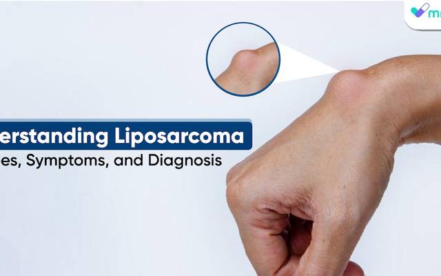 Understanding Liposarcoma: Types, Symptoms, and Diagnosis
