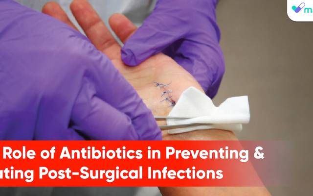 The Role of Antibiotics in Preventing and Treating Post-Surgical Infections