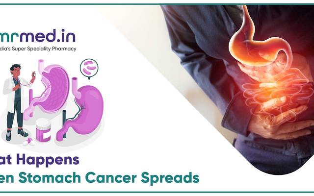How Metastatic Stomach Cancer Progresses and What It Means for Patients