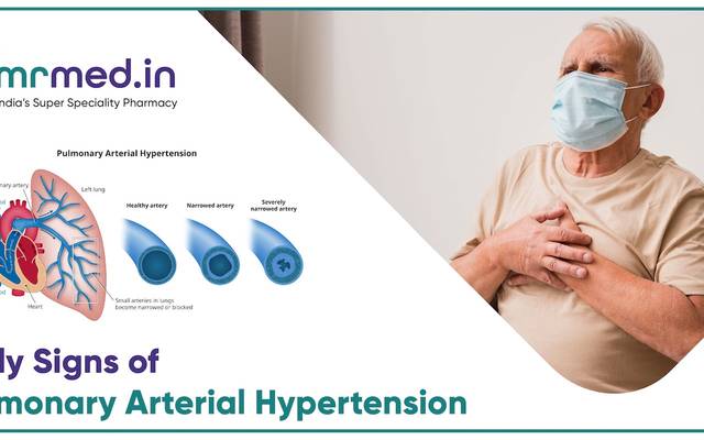 Early warning signs of pulmonary arterial hypertension you should not ignore