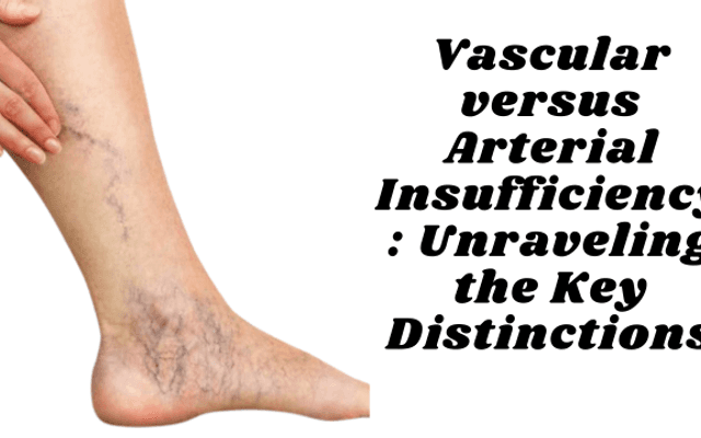 Vascular versus Arterial Insufficiency: Unraveling the Key Distinctions