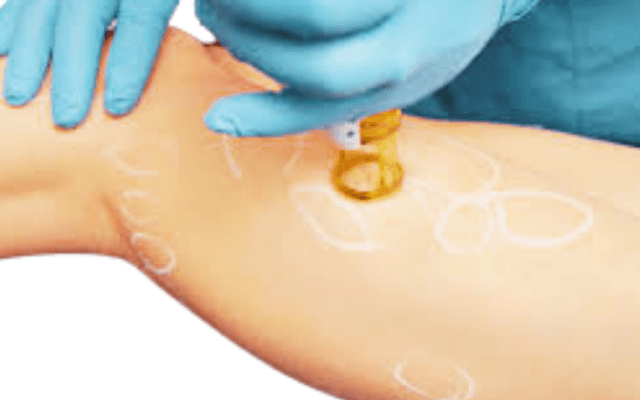 The Science behind Hemosiderin Discoloration: Exploring its Causes and Implications