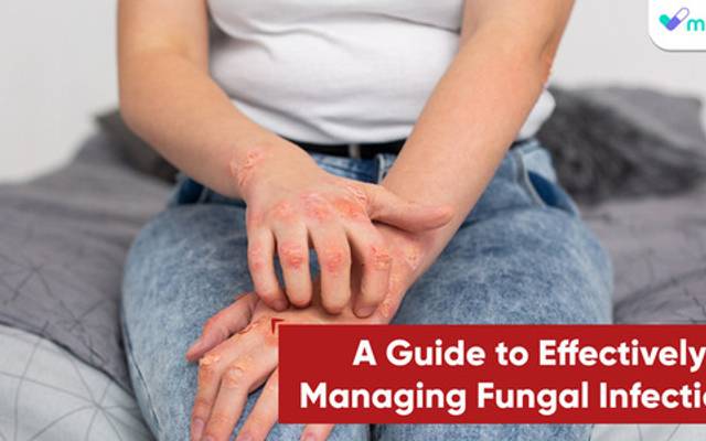 A Guide to Effectively Managing Fungal Infections

