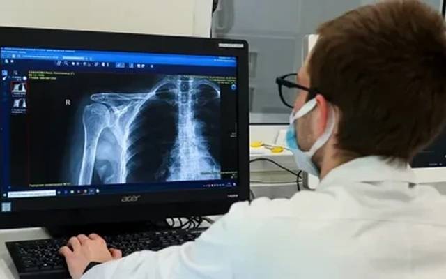 Backscatter X-Ray Devices Market Types, End Users and Application, 2031