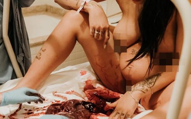 Você conheceu sua placenta?