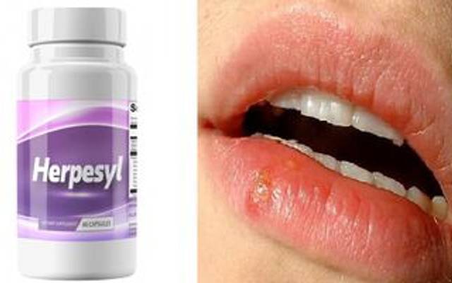 Herpesyl Don't Buy Before Read Official Reviews!