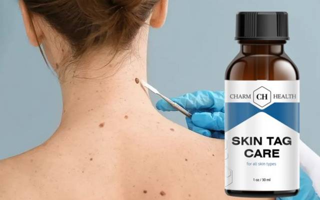 Charm Health Skin Tag Remover (CONSUMER WARNING): Experts Reveal What Most Like!