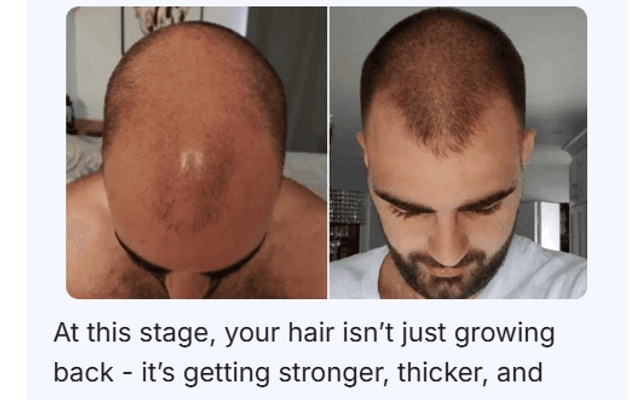 ReGenixal Hair Recover New Zealand Will Help You Reclaim Happiness!