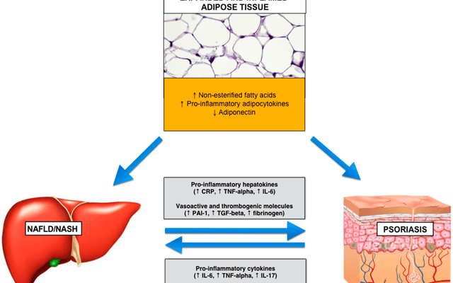 Hepato Burn: Total Liver Support System for Energy, Clarity, and Body Reset