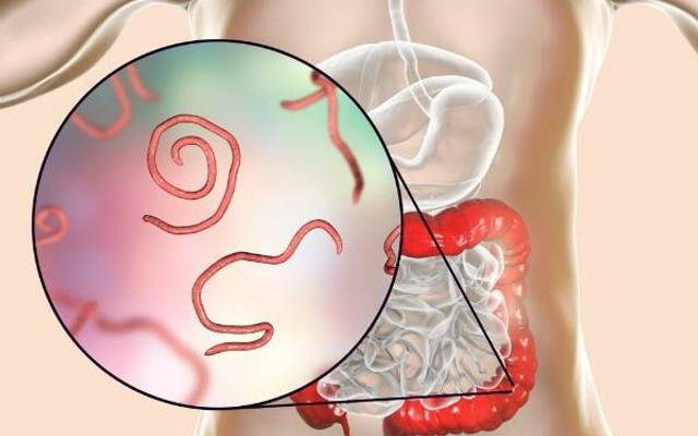 

Para911 Parasites Cleanse Drops Canada Reviews : Natural Safe And Effective!!