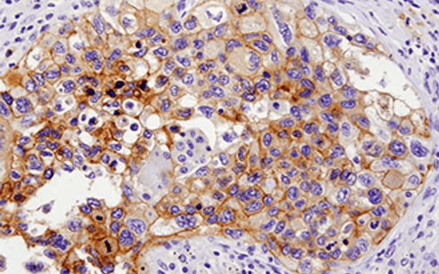 Japan Immunohistochemistry Market Size, Share, Growth, and Forecast 2025-2033