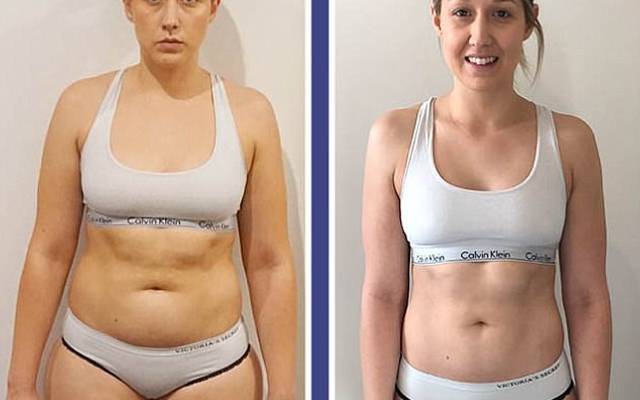 Teenlab Fast Slim Day Capsules: The Key to Daytime Weight Loss