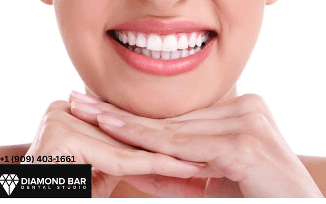 Dental Implants in Diamond Bar: Natural, Secure Tooth Replacement That Lasts
