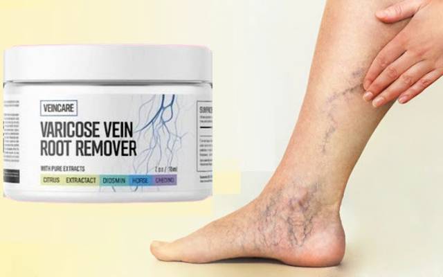 Veincare Varicose Vein Root Remover™ Canada: Supports Overall Vein Health