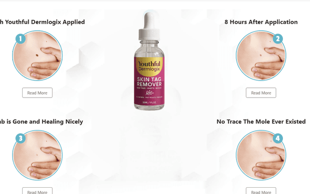 

Youthful Dermlogix Skin Tag Remover Best Result Using This