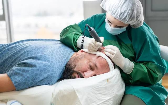 India Hair Transplant Market Growth Analysis, Demand Drivers and Research Report by 2033