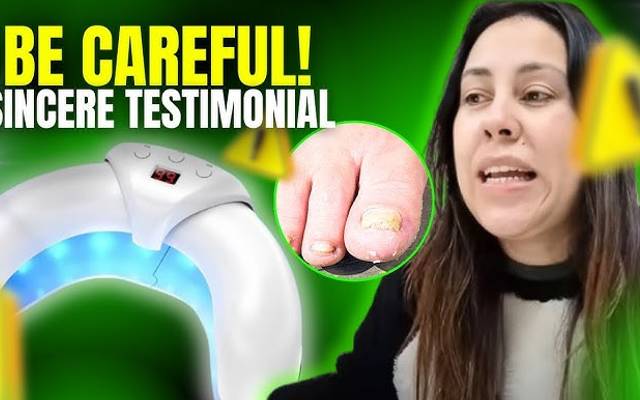 FungaBeam™ Nail Fungus Device — The Painless, Chemical-Free Way to Restore Healthy Nails