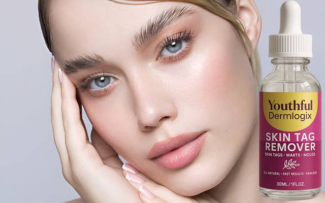 Is Youthful Dermlogix Skin Tag Remover the Best Over-the-Counter Solution for Skin Tags and Moles?