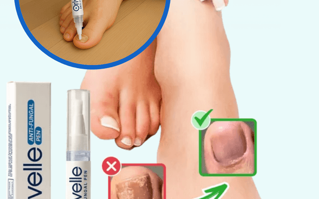 Orivelle Fungus Pen  For erectile Dysfunction.