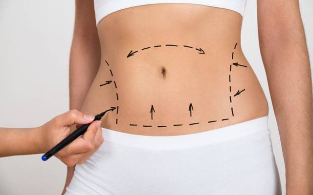 Does a Tummy Tuck Improve Body Contour?
