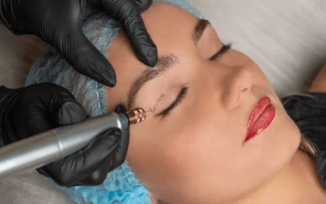 How Many Plasma Pen Sessions Are Usually Required?