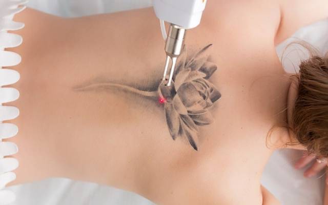 Is PicoSure Effective for Black Ink Tattoos?