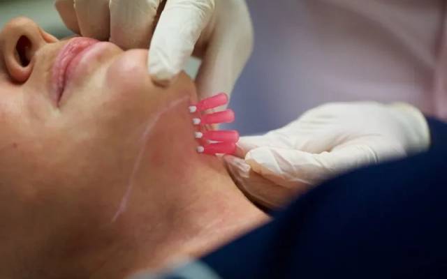 How Many PDO Mono Threads Are Needed Per Session?