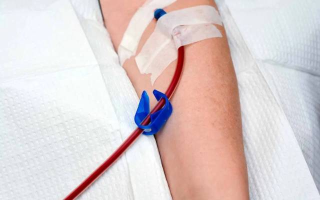 How Does IV Ozone Therapy Support Cellular Anti-Aging Processes?