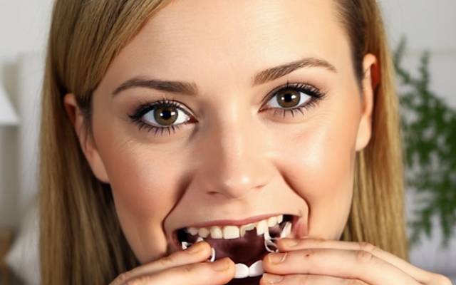 Shiny Smile Veneers Reviews How Do They Fit? The Truth About the Impression Kit