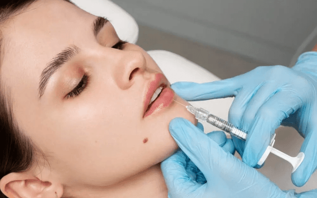 How Soon Are Lip Filler Results Visible?