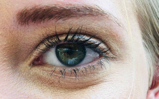 How Reliable Is Dark Circles Treatment for Eye Concerns?
