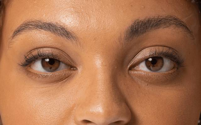 Educational Guide to Dark Circles Treatment Concepts