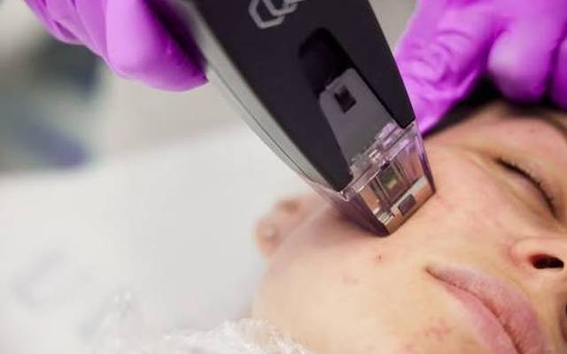 What Skin Concerns Can Morpheus8 Treatment Address?