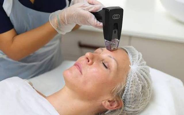 Does Morpheus8 Treatment Improve Overall Skin Tone?