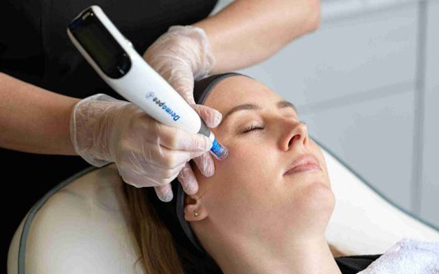 Does Dermapen Treatment Support Collagen Production?
