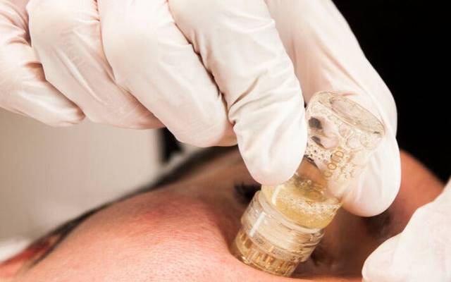 What Can You Expect After an AquaGold Facial?