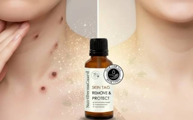 NutriDermaGuard Skin Tag Remover Review - Should You Buy?