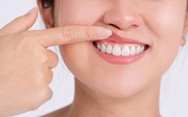 Healthy vs Unhealthy Gums: Causes and Prevention Guide