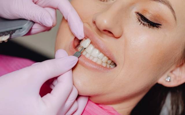 How Do Composite Veneers Function in Smile Design?