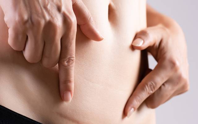 What Is the Purpose of Surgical Scar Revision?