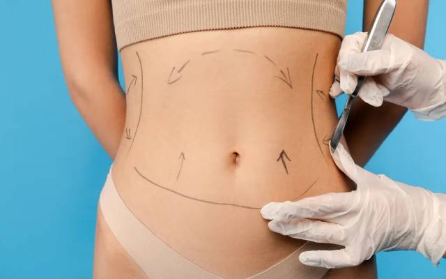 What Is the Anatomical Goal of Lipo Abdominoplasty?