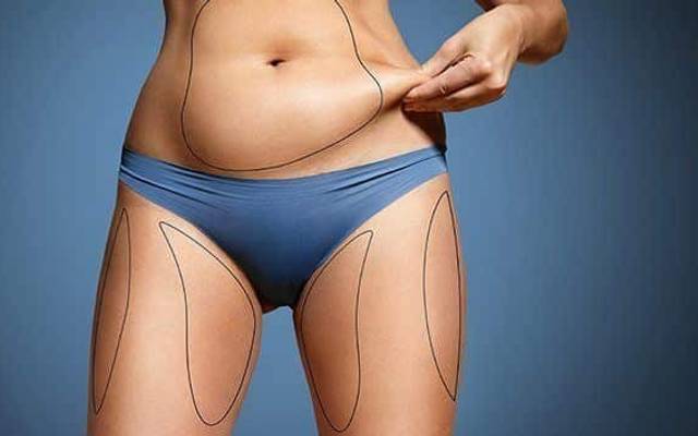 What Is the Science Behind Fat Transfer Surgery?