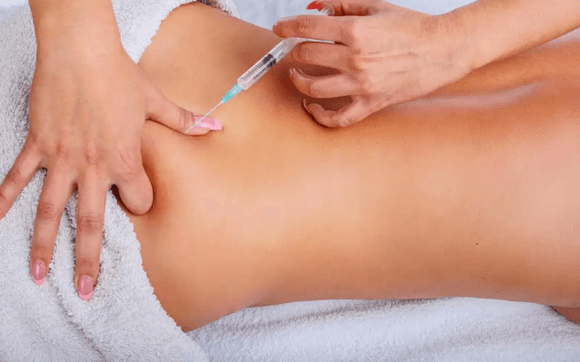 Is Hyacorp Filler for Buttocks a Volumizing Option?