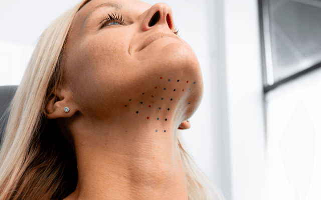 Is Kybella Treatment for Double Chin Suitable for Your Anatomy?