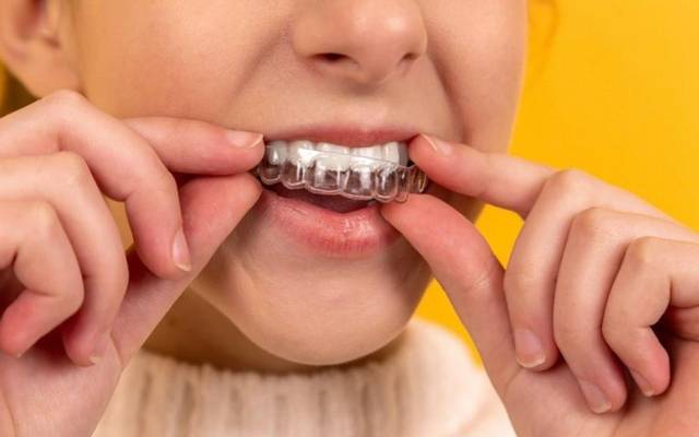 Is a Mouth Guard Necessary for Sleep?