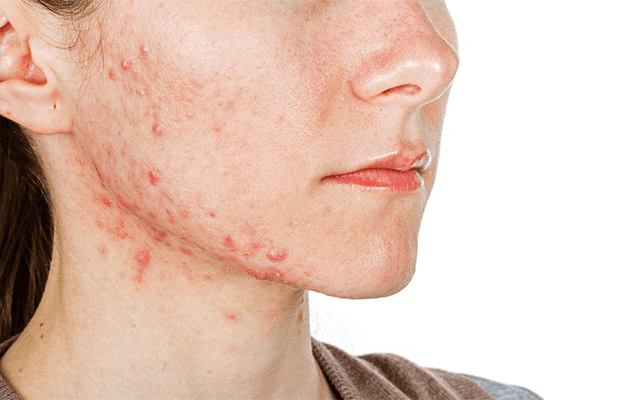 What Skin Diseases Treatment Options Exist?