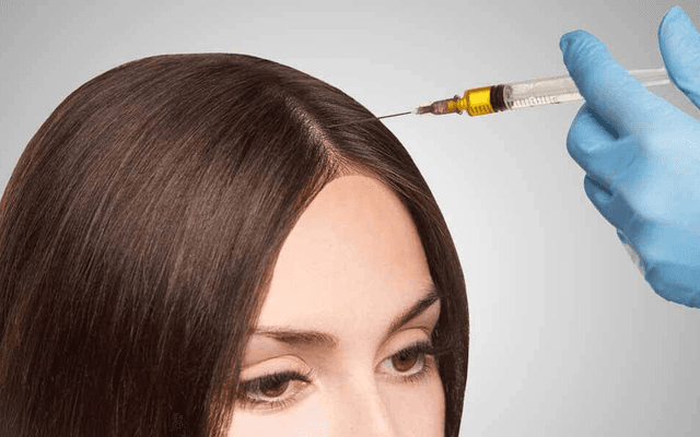 Best PRP Hair Treatment for Thinning Hair